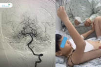 Bé trai 10 tuổi suýt liệt nửa người sau khi đi chơi cầu lông