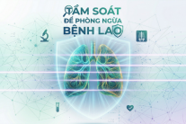 Khám sức khỏe định kỳ - 'chìa khóa' phát hiện sớm bệnh lao trong cộng đồng