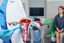 Các yếu tố ảnh hưởng đến u xơ tử cung sau tuổi 30