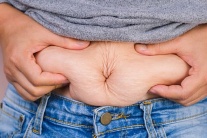 Tăng nguy cơ mắc nhiều loại ung thư do béo phì