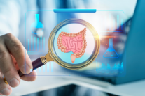 Bác sĩ chỉ ra 5 sai lầm phổ biến làm tăng nguy cơ ung thư đại trực tràng