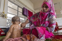 Bangladesh: Gần 100 trẻ em tử vong nghi do dịch sởi bùng phát