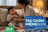 Podcast: Cách chăm sóc trẻ mắc tay chân miệng tại nhà