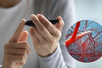 Mắc đái tháo đường: Cần biết gì về biến chứng mạch máu nhỏ của bệnh?