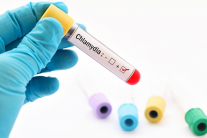 Điểm giống và khác giữa chlamyda và bệnh lậu là gì?