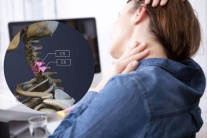 Thoát vị đĩa đệm C5-C6 phải làm sao?