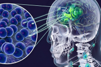 4 trường hợp tử vong do mắc viêm não mô cầu, Bộ Y tế phát cảnh báo