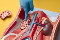 Suy thận độ 2: Chế độ dinh dưỡng giúp ngăn bệnh trở nặng