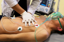 Sự thật về đột quỵ khi chơi thể thao