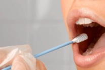 Xét nghiệm nước bọt tại nhà giúp phát hiện sớm ung thư dạ dày