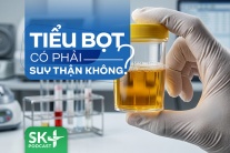 Podcast: Tiểu bọt có phải suy thận không?