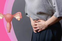 Giải pháp giúp kiểm soát u nang buồng trứng an toàn 