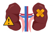 Suy thận độ 1 biểu hiện như thế nào?