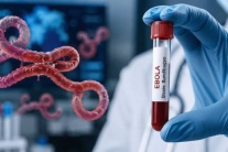 Biết gì về virus Bundibugyo có liên quan đến dịch Ebola?