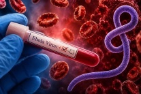 Bộ Y tế: Hướng dẫn chẩn đoán và điều trị bệnh do virus Ebola năm 2026