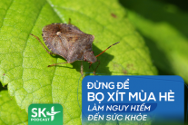 Podcast: Đừng để bọ xít mùa Hè làm nguy hiểm đến sức khỏe