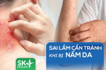 Podcast: Sai lầm cần tránh khi bị nấm da