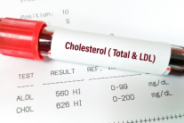 Ăn uống bình thường vẫn tăng cholesterol máu: Nguyên nhân từ đâu?