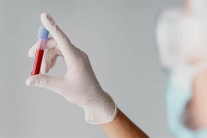 Tại sao đường huyết ổn định nhưng HbA1c vẫn cao?