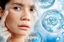 Nguy cơ từ làm đẹp bằng NMN, NAD+ và tế bào gốc