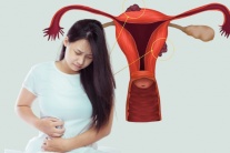 Sang chấn tâm lý có thể thúc đẩy bệnh lạc nội mạc tử cung
