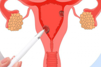 Vì sao PMOS gây thèm đồ ngọt?