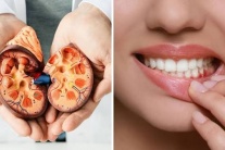 Từ chảy máu chân răng đến nguy cơ tổn thương thận
