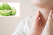 Bị bướu cổ lành tính có nên ăn rau cải bắp?