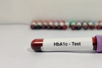 Đái tháo đường: Chỉ số HbA1c 8,9% làm cách nào để hạ?