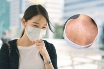 Người lớn cũng bị sởi: Bà bầu cần lưu ý gì?