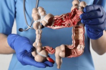 Căn bệnh ung thư gia tăng mạnh ở người trẻ