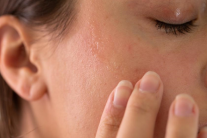 5 nguyên nhân khiến da vẫn khô dù dưỡng ẩm thường xuyên