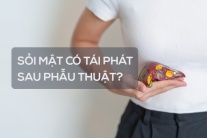 Sỏi mật có tái phát sau phẫu thuật không?