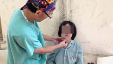 'Trả lại' khuôn mặt biến dạng gần 20 năm vì u xơ thần kinh