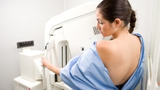 10 xét nghiệm sàng lọc Ung thư phụ nữ nhất định phải làm (P2)