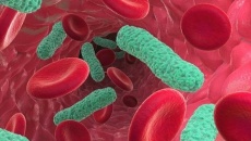 Nhiễm trùng máu là gì?
