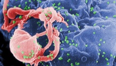 Bước đột phá y học mới: Đã có thể chữa trị hoàn toàn HIV