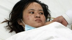 Bệnh viêm não mô cầu nguy hiểm như thế nào