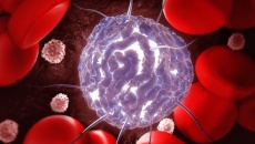 Những điều cần biết về ghép tế bào gốc điều trị ung thư máu