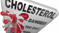 Những thực phẩm làm tăng cholesterol xấu gây hại sức khỏe