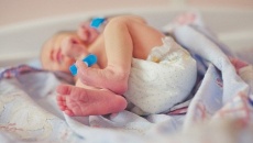 Trẻ sinh mổ có nguy cơ mắc đái tháo đường, béo phì cao gấp 3 lần