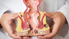 Ung thư hậu môn: Những triệu chứng cần cảnh giác