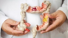 3 loại Ung thư đường tiêu hóa dễ mắc phải nhất mà bạn cần cảnh giác