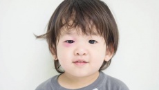 Đau mắt ở trẻ sơ sinh và trẻ nhỏ: Do đâu và điều trị thế nào?