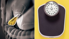 Chế độ ăn kiêng nghiêm ngặt, giảm cân quá nhanh có thể gây sỏi mật?