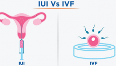 IUI và IVF: Phương pháp điều trị vô sinh nào phù hợp với bạn? 