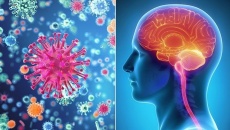 6 điều bạn nên biết về viêm màng não