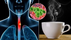 Uống trà nóng có làm tăng nguy cơ Ung thư thực quản?