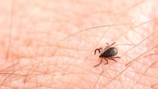 Dấu hiệu cảnh báo nguy hiểm khi nhiễm trùng do bọ ve đốt (bệnh Lyme) 