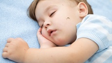 5 cách phòng tránh muỗi đốt cho trẻ để tránh bệnh sốt xuất huyết, sốt rét